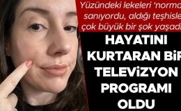 Yüzündeki lekeleri ‘normal’ sanıyordu, aldığı teşhisle çok büyük bir şok yaşadı! Hayatını kurtaran bir televizyon programı oldu