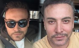 Estetik operasyonunun ardından Cenk Eren’e nazar değdi