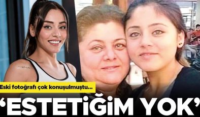 Ünlü oyuncunun değişimi dikkat çekmişti… ‘Estetiğim yok!’